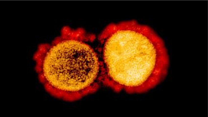 Novel coronavirus SARS CoV2, which causes COVID-19. Meanwhile, new COVID mutations called variants have spread across the U.S., including the newer Omicron variant.
MICROPHOTOGRAPHY BY NATIONAL INSTITUTE ON ALLERGY AND INFECTIOUS DISEASES.